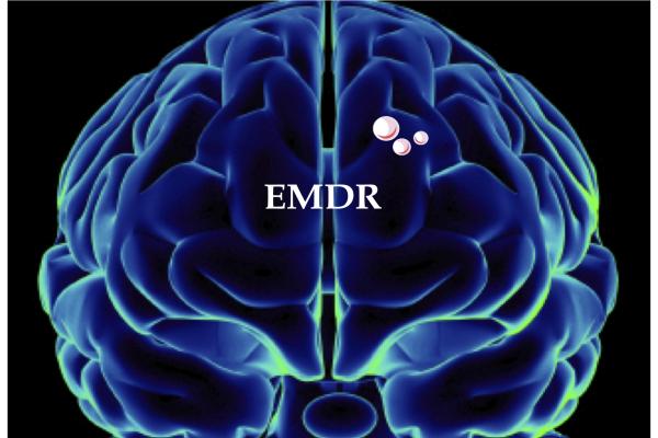 EMDR